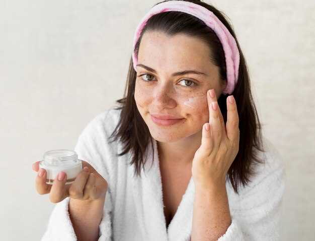 Benefits of Doxycycline Monohydrate for Acne