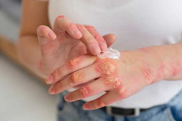 Causes of Rash and Skin Irritation