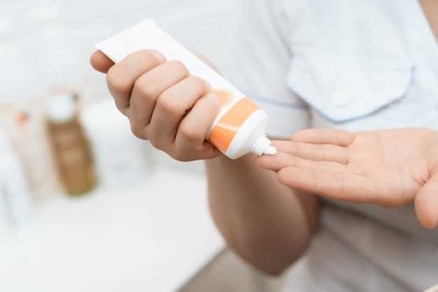 Benefits of Using Doxycycline Ointment