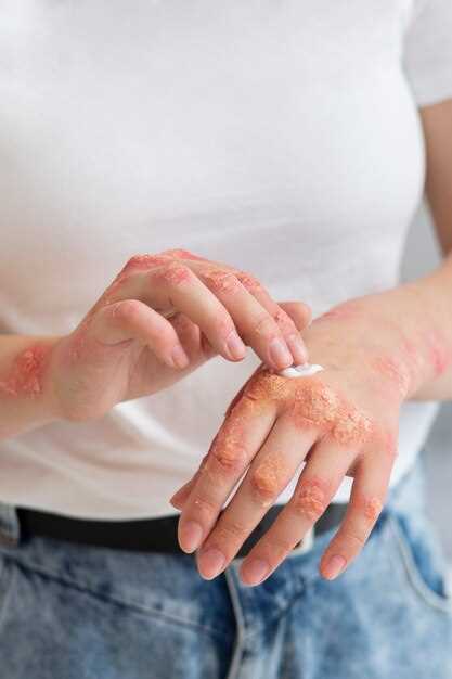 Symptoms of the rash