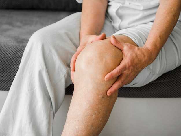 Can doxycycline cause leg swelling
