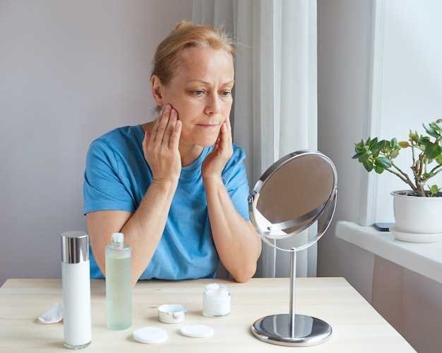 Cheaper alternative to doxycycline for acne