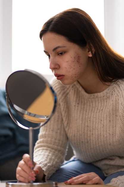 Does doxycycline help with rosacea