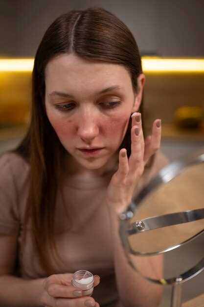 Doxycycline acne yeast infection