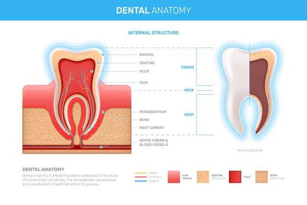 Doxycycline and periodontitis