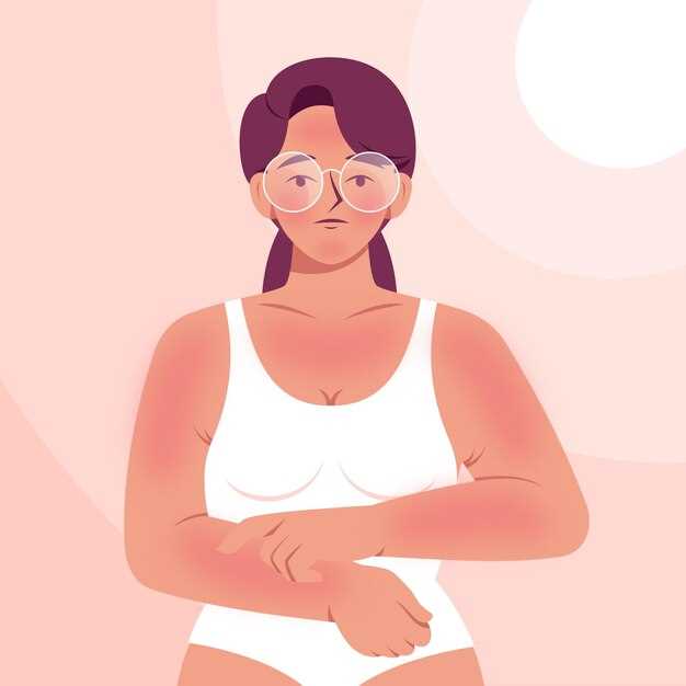 Doxycycline and skin irritation