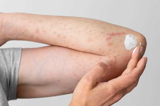 Doxycycline and skin rashes
