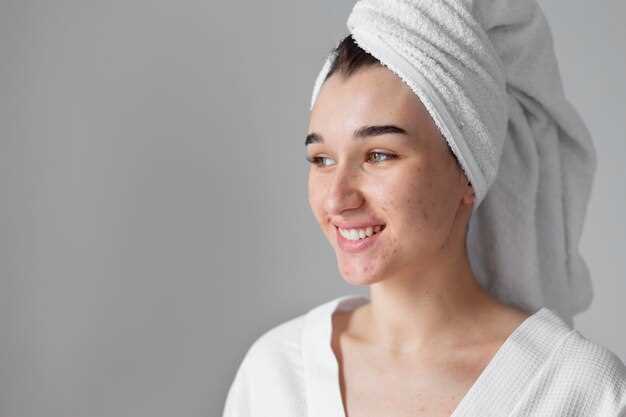 Doxycycline cures rosacea