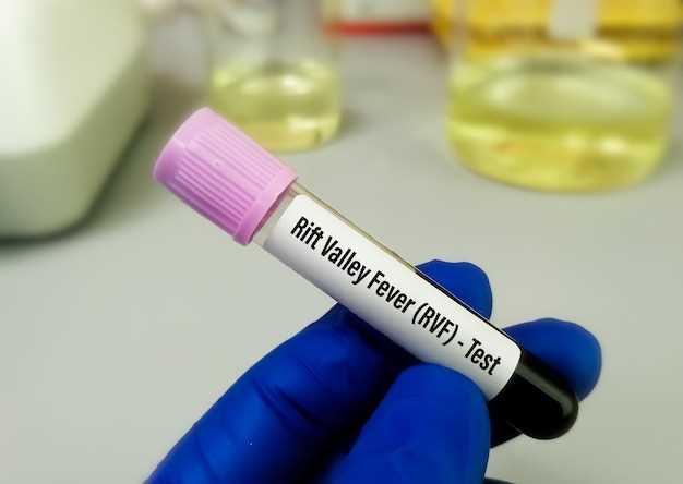 Doxycycline hyclate lyme disease dosage