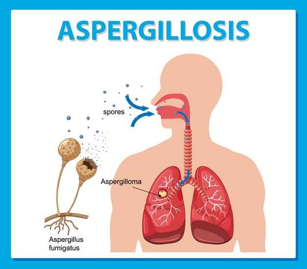 Doxycycline in respiratory tract infection