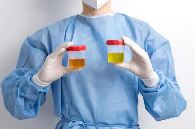 Doxycycline in treating uti