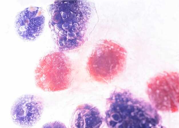 Doxycycline induced-acute pancreatitis