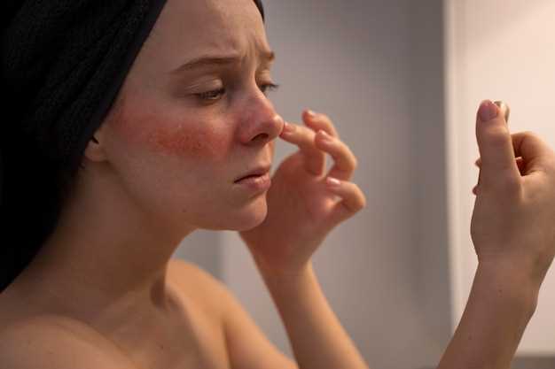 Doxycycline rosacea 100 twice daily day