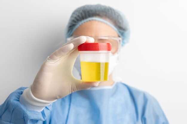 Doxycycline urine infection