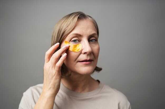 Doxycycline used for blepharitis