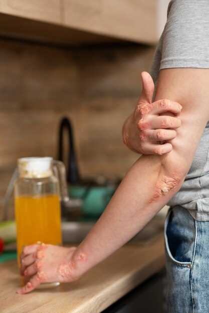 Doxycycline with tums