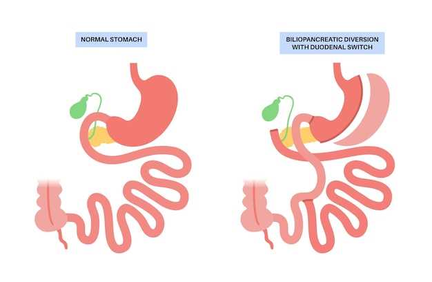 Esophageal ulcer caused by doxycycline