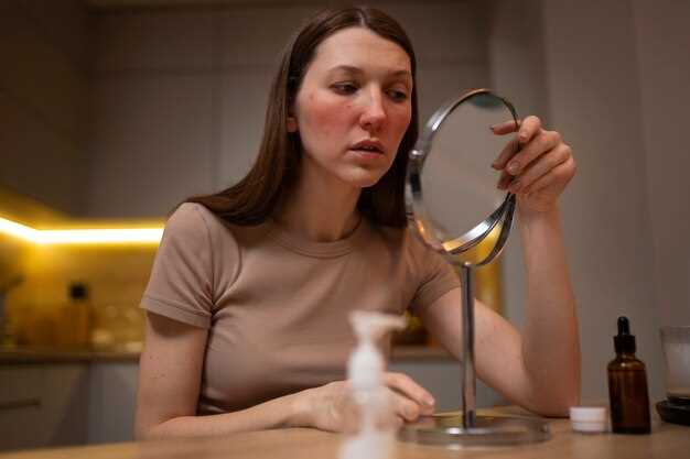 High dose doxycycline acne