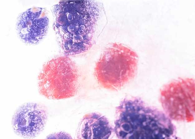 Systemic lupus erythematosus doxycycline